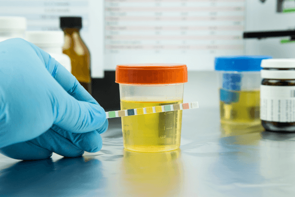 Gloved hand holding a multi-panel urine drug test strip above a specimen cup containing yellow urine, demonstrating how a 10-panel drug test is performed in a clinical setting.