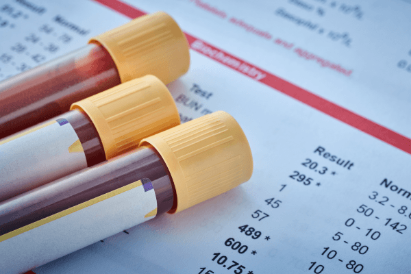 Blood collection tubes with yellow caps resting on a laboratory biochemistry report showing test results and reference ranges, representing clinical drug testing processes for a 10-panel drug screen.